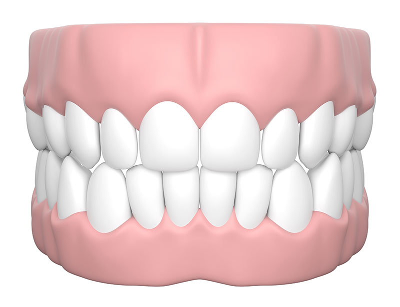 歯ぐきの整形（ガムピーリング・歯肉形成）